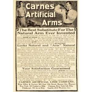 1913 Vintage Ad Carnes Artificial Arms Limb Amputee   Original Print 