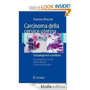Carcinoma della cervice uterina: Eziopatogenesi e profilassi (Italian 