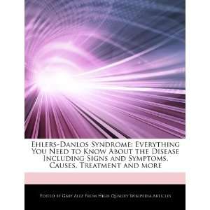  Ehlers Danlos Syndrome Everything You Need to Know About 