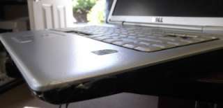 Dell Inspiron 1525 Laptop Computer with Windows Vista Dual Core 