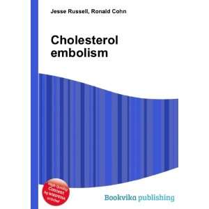  Cholesterol embolism Ronald Cohn Jesse Russell Books